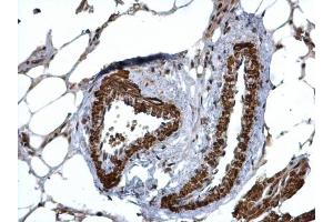 IHC-P Image HUS1 antibody detects HUS1 protein at cytosol and nucleus on mouse lymph node by immunohistochemical analysis. (HUS1 anticorps  (Center))