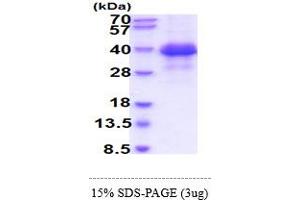SDS-PAGE (SDS) image for Fc Fragment of IgE, Low Affinity II, Receptor For (CD23) (FCER2) (AA 48-321) protein (His tag) (ABIN7281312)