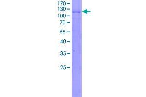 Image no. 1 for Thymocyte Selection Associated (THEMIS) (AA 1-641) protein (GST tag) (ABIN2752947)