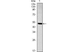Western blot analysis using SMAD2 mAb against human SMAD2 (AA: 20-254) recombinant protein.