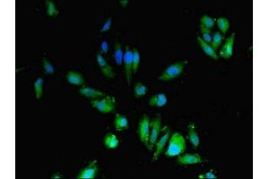 Immunofluorescent analysis of Hela cells using ABIN7149082 at dilution of 1:100 and Alexa Fluor 488-congugated AffiniPure Goat Anti-Rabbit IgG(H+L)