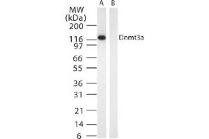 DNMT3A mAb tested by Western blot. (DNMT3A anticorps)