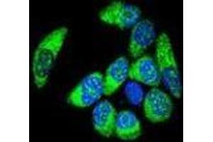 Confocal immunofluorescent analysis of WT1 Antibody (Center E361) with MCF-7 cell followed by Alexa Fluor® 488-conjugated goat anti-rabbit lgG (green).