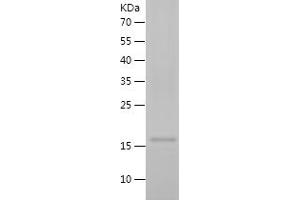 Western Blotting (WB) image for Caspase 1 (CASP1) (AA 120-269) protein (His tag) (ABIN7122160)