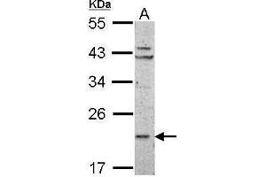 RPL11 anticorps