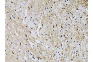 Immunohistochemistry of paraffin-embedded rat heart using HUS1 antibody (ABIN6131776, ABIN6142084, ABIN6142086 and ABIN6218116) at dilution of 1:100 (40x lens).