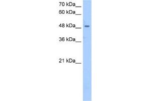 WB Suggested Anti-SSB Antibody Titration:  2. (SSB anticorps  (Middle Region))