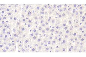 Detection of PLTP in Rat Liver Tissue using Polyclonal Antibody to Phospholipid Transfer Protein (PLTP) (PLTP anticorps  (AA 337-479))