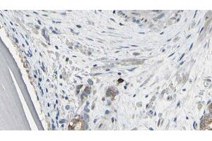 anti-Eukaryotic Translation Initiation Factor 3 Subunit J (EIF3S1) (Internal Region) antibody
