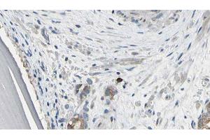 ABIN6279421 at 1/100 staining Human prostate tissue by IHC-P. (EIF3S1 anticorps  (Internal Region))