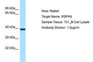 Image no. 1 for anti-Radial Spoke Head 9 Homolog (RSPH9) (AA 52-101) antibody (ABIN6749895) (RSPH9 anticorps  (AA 52-101))