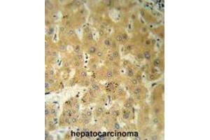 Immunohistochemistry (IHC) image for anti-Transthyretin (TTR) antibody (ABIN3002755)