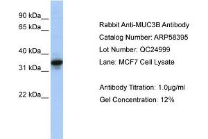 WB Suggested Anti-MUC3B  Antibody Titration: 0. (MUC3B anticorps  (N-Term))