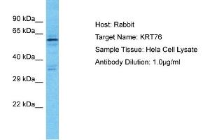 Host: Rabbit Target Name: KRT76 Sample Type: Hela Whole Cell lysates Antibody Dilution: 1. (Cytokeratin 2 anticorps  (C-Term))