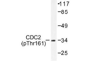 Image no. 1 for anti-Cyclin-Dependent Kinase 1 (CDK1) (pThr161) antibody (ABIN317981) (CDK1 anticorps  (pThr161))
