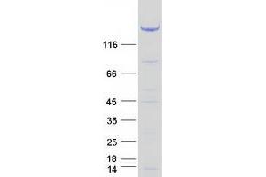 Validation with Western Blot