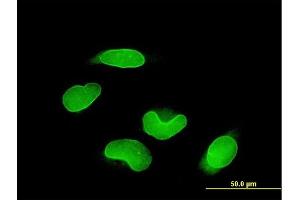 Immunofluorescence of monoclonal antibody to RUNX1T1 on HeLa cell.