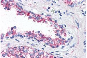 Anti-5HT1B Receptor antibody  ABIN1048254 IHC staining of human prostate. (5HT1B Receptor anticorps  (Internal Region))