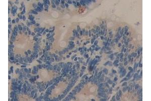Detection of C7 in Rat Intestine Tissue using Polyclonal Antibody to Complement Component 7 (C7) (C7 anticorps  (AA 1-144))