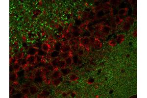 Immunohistochemistry (IHC) image for anti-Cell Adhesion Molecule 2 (CADM2) (AA 167-181) antibody (ABIN1742492)