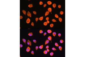 Immunofluorescence analysis of L929 cells using SMPD4 Rabbit pAb (ABIN7270531) at dilution of 1:100.