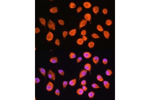 Immunofluorescence analysis of L929 cells using SMPD4 Rabbit pAb (ABIN7270531) at dilution of 1:100. (SMPD4 anticorps  (AA 600-800))