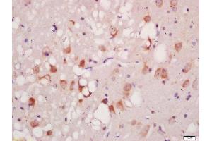 Formalin-fixed and paraffin embedded rat brain labeled with Anti-Phospho-ATG1(Ser556)Polyclonal Antibody, Unconjugated  at 1:200 followed by conjugation to the secondary antibody and DAB staining