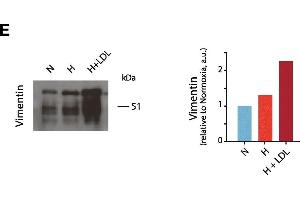 Lipid loading augments hypoxia mediated secretion of pro-tumorigenic factors. (Vimentin anticorps)