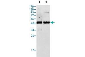 Western blot analysis of AMACR monoclonal antibody, clone 2A10F3  against Jurkat (1) and LNCaP (2) cell lysate.
