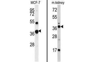 Image no. 1 for anti-Fructose-1,6-Bisphosphatase 1 (FBP1) (Middle Region) antibody (ABIN452992) (FBP1 anticorps  (Middle Region))