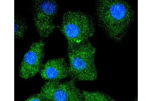 A549 cells were stained with Cytokeratin 13 (5A3) Monoclonal Antibody  at [1:200] incubated overnight at 4C, followed by secondary antibody incubation, DAPI staining of the nuclei and detection. (Cytokeratin 13 anticorps)