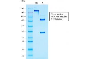 SDS-PAGE Analysis Purified MUC1 Mouse Recombinant Monoclonal Antibody (rMUC1/960).