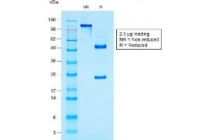 SDS-PAGE Analysis Purified MUC1 Mouse Recombinant Monoclonal Antibody (rMUC1/960). (Recombinant MUC1 anticorps)