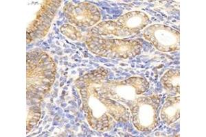 Immunohistochemistry analysis of paraffin-embedded mouse uterus using,INSR (ABIN7074298) at dilution of 1: 6000