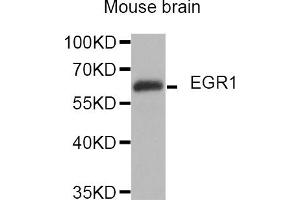 Western blot analysis of extracts of mouse brain, using EGR1 antibody (ABIN5974370). (EGR1 anticorps)