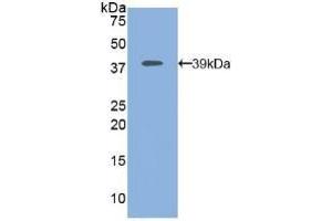 Detection of Recombinant MAP2K1, Human using Polyclonal Antibody to Mitogen Activated Protein Kinase Kinase 1 (MAP2K1) (MEK1 anticorps  (AA 54-369))