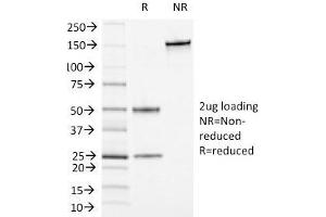 SDS-PAGE Analysis Purified CD13 Mouse Monoclonal Antibody (APN/1464). (CD13 anticorps)