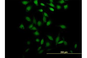 Immunofluorescence of purified MaxPab antibody to PSRC2 on HeLa cell. (ZFC3H1 anticorps  (AA 1-358))