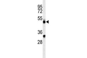 Western blot analysis of CFP antibody and CEM lysate. (CFP anticorps  (AA 197-223))