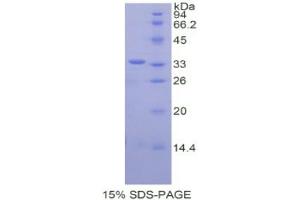 SDS-PAGE analysis of Human CREB Binding Protein. (CBP Protéine)