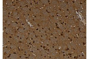 ABIN6278675 at 1/100 staining Rat brain tissue by IHC-P. (MAGEC1 anticorps)