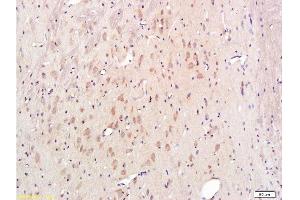 Formalin-fixed and paraffin embedded rat brain labeled with Rabbit Anti-Cytochrome C Polyclonal Antibody, Unconjugated  1:300 followed by conjugation to the secondary antibody and DAB staining
