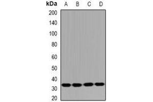 Western blot analysis of HUS1B expression in Jurkat (A), mouse spleen (B), mouse thymus (C), rat testis (D) whole cell lysates. (HUS1B anticorps)