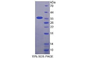 SDS-PAGE analysis of Human WWP2 Protein. (WWP2 Protéine)