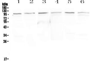 Western blot analysis of MVP using anti-MVP antibody .