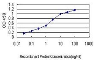 Detection limit for recombinant GST tagged UBR1 is approximately 0. (UBR1 anticorps  (AA 2-100))