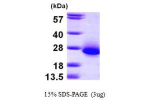Chromosome 6 Open Reading Frame 108 (C6orf108) (AA 1-174) protein (His tag)