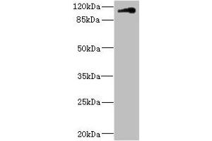 Western blot All lanes: CNTN4 antibody IgG at 1. (Contactin 4 anticorps  (AA 777-1026))