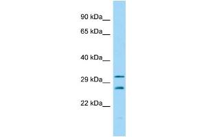 Host:  Rabbit  Target Name:  Csnk2b  Sample Type:  Mouse Testis lysates  Antibody Dilution:  1. (CSNK2B anticorps  (N-Term))