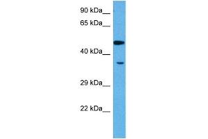Host:  Rabbit  Target Name:  MEF2A  Sample Tissue:  Rat Skeletal Muscle  Antibody Dilution:  1ug/ml